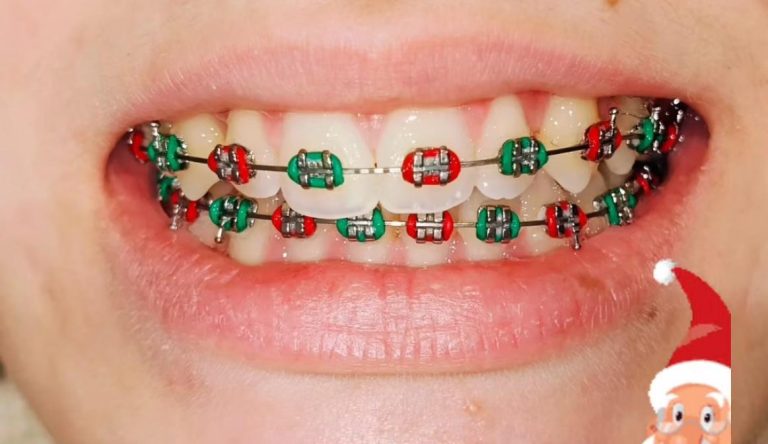 ortodoncia dental arganda