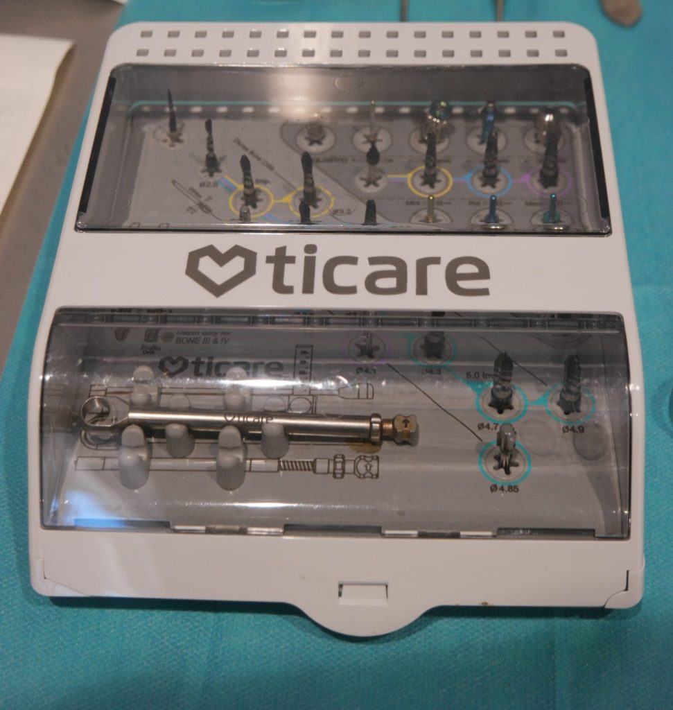 Dental Arganda Ticare implantes